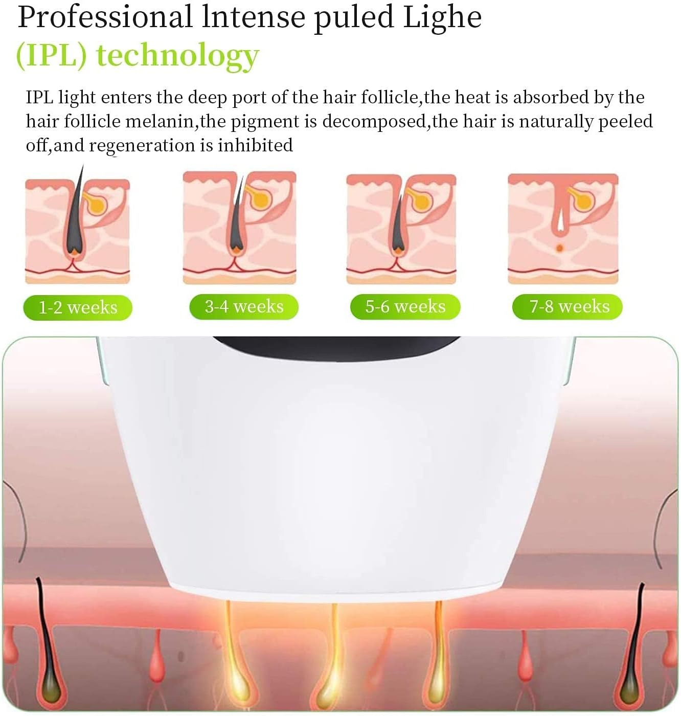 IPL Hair Removal System Digitalshoper
