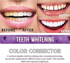 Toothpaste for Teeth Whitening (30ml) Digitalshoper